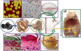 Bioactive Phoenix dactylifera seeds incorporated chitosan/hydroxyapatite nanoconjugate for prospectiv