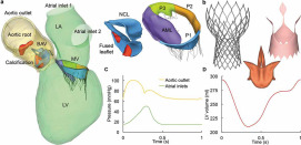 The Impact of Self-Expandable Transcatheter Aortic Valve Replacement on Concomitant Functional Mitral