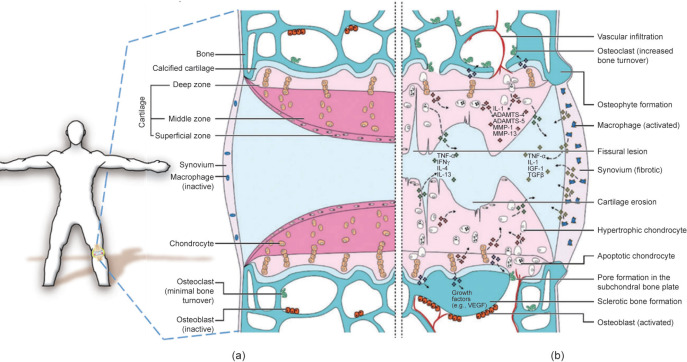 Regenerative Engineering for Knee Osteoarthritis Treatment: Biomaterials and Cell-Based Technologies