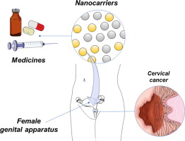 Highlights in nanocarriers for the treatment against cervical cancer