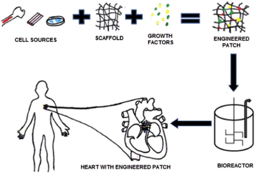 Biomaterials and cells for cardiac tissue engineering: Current choices