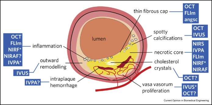 Intravascular imaging for characterization of coronary atherosclerosis