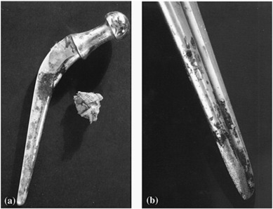 Corrosion and surface modification on biocompatible metals: A review