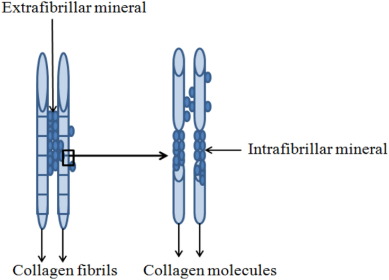 Bioactive glass for dentin remineralization: A systematic review