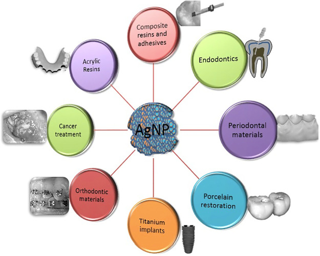 An overview of application of silver nanoparticles for biomaterials in dentistry