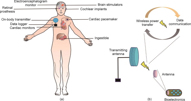 Recent Advances in Organ Specific Wireless Bioelectronic Devices: Perspective on Biotelemetry and Pow