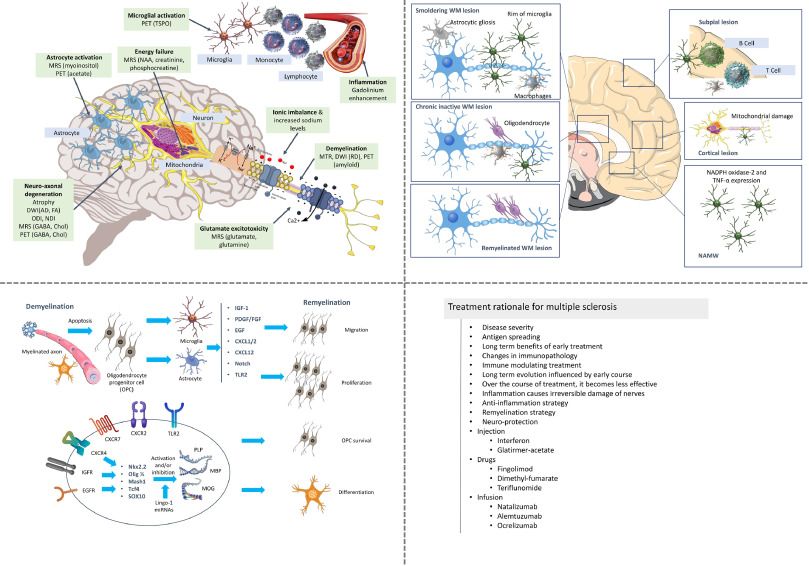 Neural stem cell engineering for the treatment of multiple sclerosis