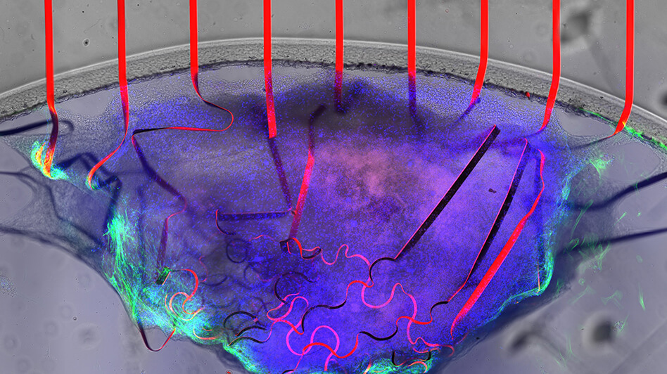 Bioelectronic mesh capable of growing with cardiac tissues for comprehensive heart monitoring